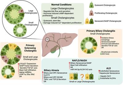 Biliary Epithelial Senescence in Liver Disease: There Will Be SASP